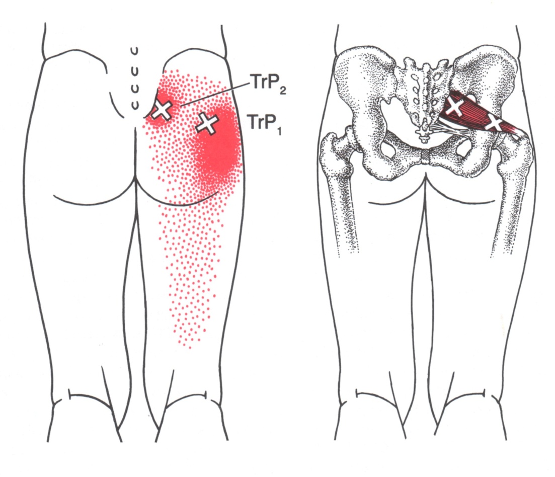 Triggerpunkte tennisball piriformis triggerpunkte tennisball