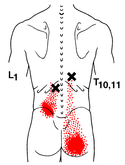 🗣Flank Pain - Quadratus Lumborum👇 . ❓Do you get Pain in this region? What  do you find relieves it? . 🎉Besides sounding like a Harry Potter spell,  the, By The Strength Therapist