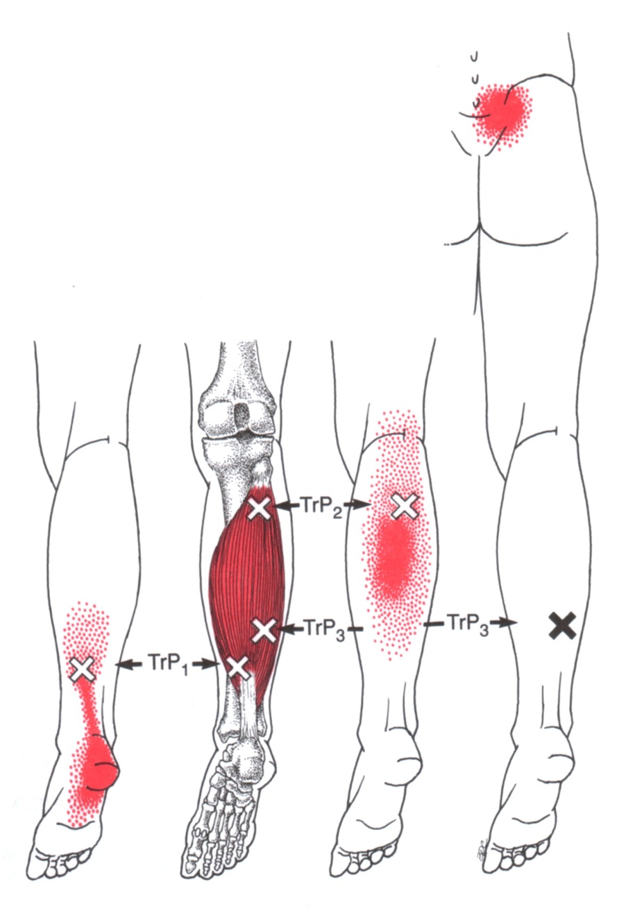 Referred Chart Foot