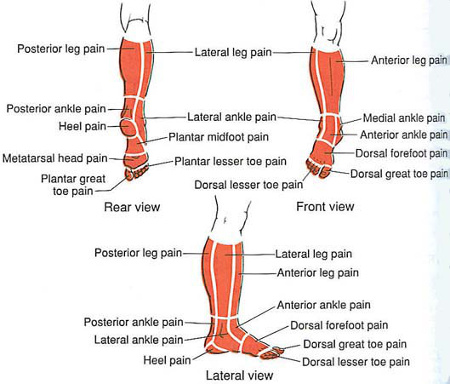 anterior heel pain
