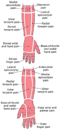Forearm pain shop