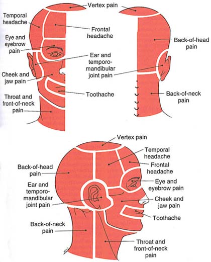 Headache Chart Top Of Head