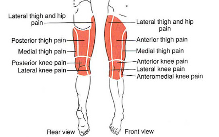 Hip Thigh Knee The Trigger Point Referred Pain Guide