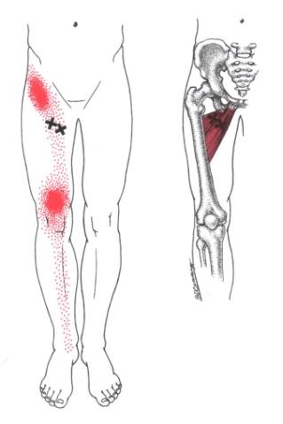 The groin muscles are delicate and sensitive. Groin Muscles Diagram : Adductor Longus And Brevis The Trigger Point Referred Pain Guide