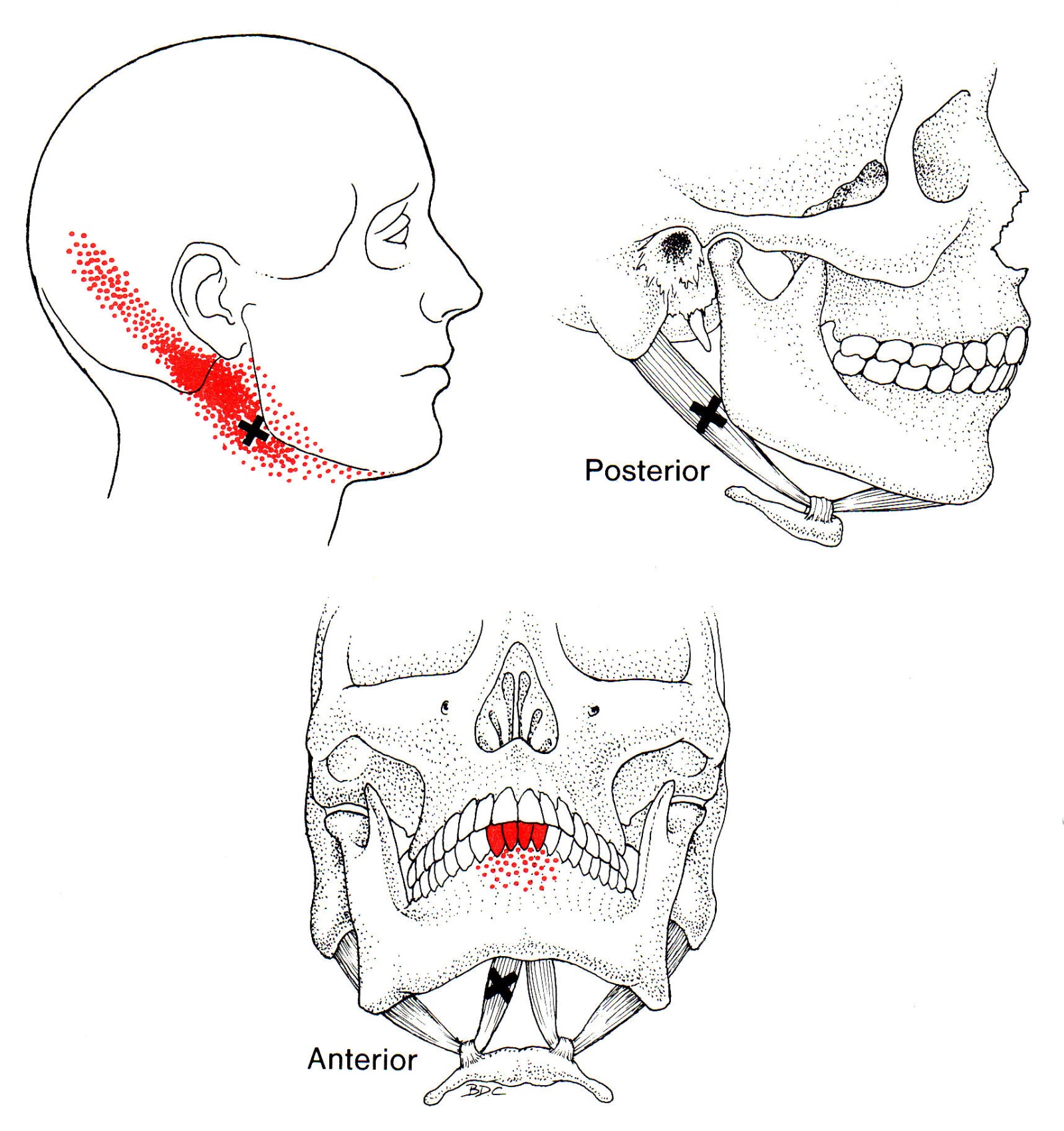 Digastric The Trigger Point & Referred Pain Guide