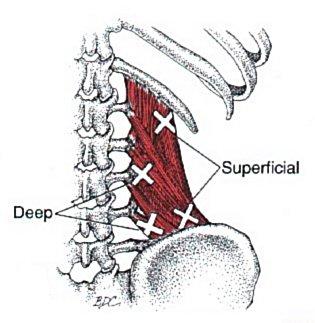 Quadratus Lumborum Trigger Points Range Of Motion TWO LETTERS CAN